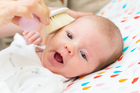 ลูกผมบางจนแม่ใจหาย