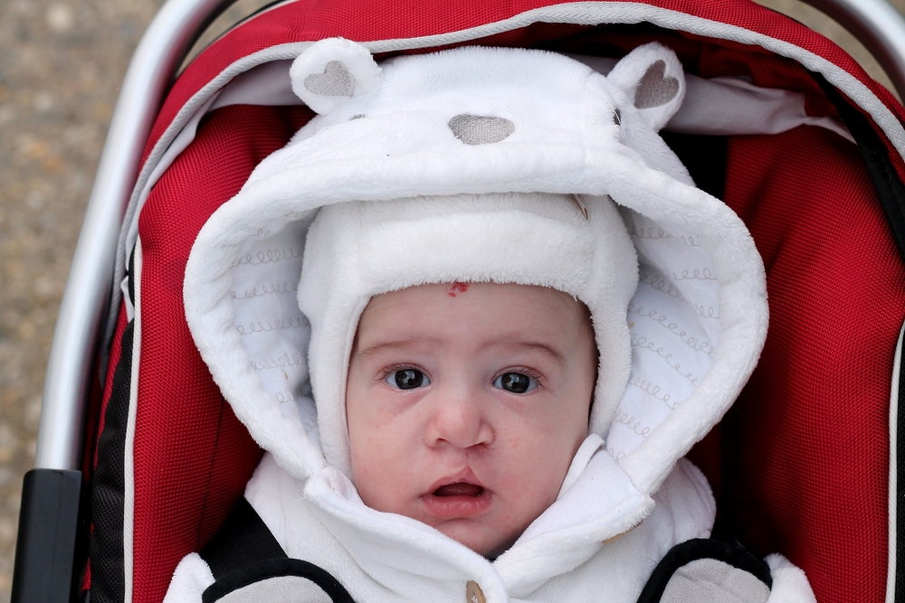 โรคปากแหว่งเพดานโหว่