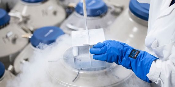 การฝากไข่