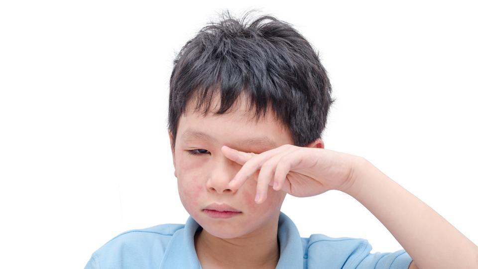 การแพ้อาหารของลูก