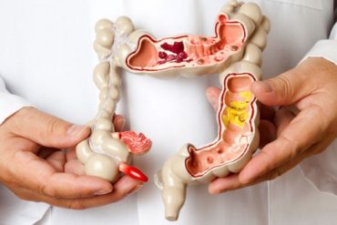 โรคลำไส้แปรปรวน