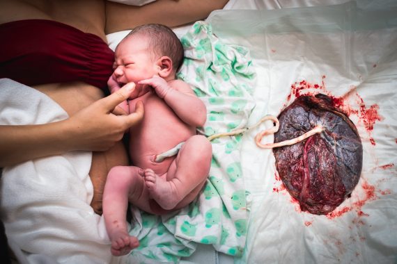 รกเด็กคืออะไร