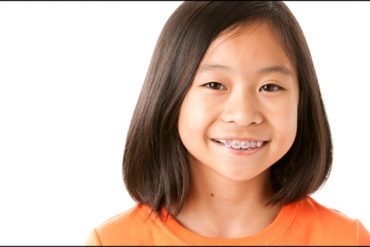 การจัดฟันเด็ก