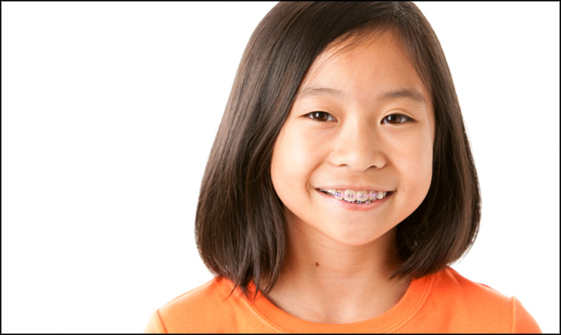 การจัดฟันเด็ก