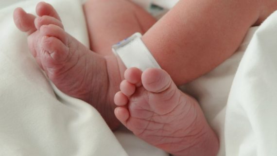 intersex คืออะไร