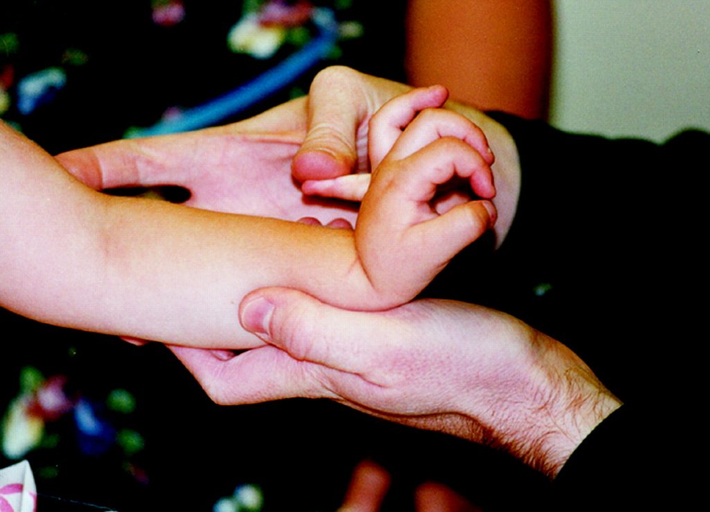 โรคเอ็นข้อหย่อนในเด็ก