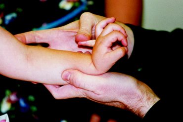 โรคเอ็นข้อหย่อนในเด็ก