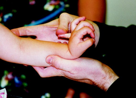 โรคเอ็นข้อหย่อนในเด็ก