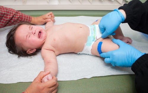 โรคไส้เลื่อนในเด็ก