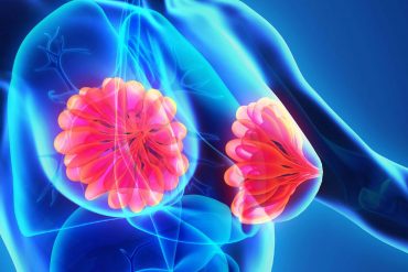 โรคเต้านมอักเสบ