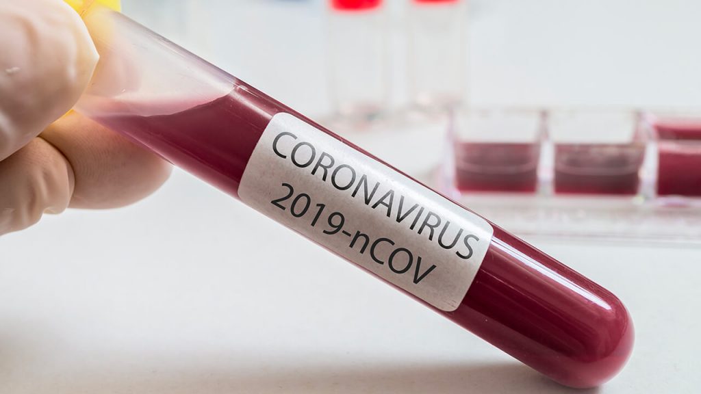 ตรวจโควิด-19 ที่ไหนได้บ้าง