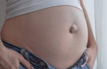 ภาวะไส้เลื่อนที่สะดือ