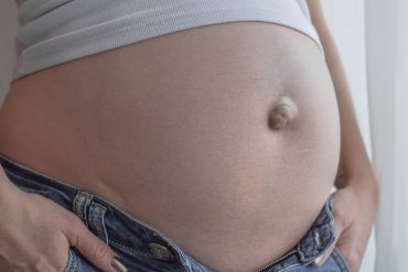 ภาวะไส้เลื่อนที่สะดือ