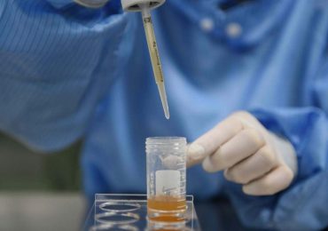 พบเชื้อไวรัสในอสุจิ