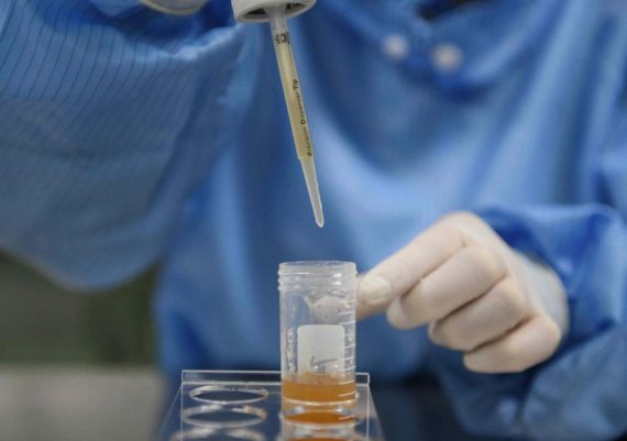 พบเชื้อไวรัสในอสุจิ