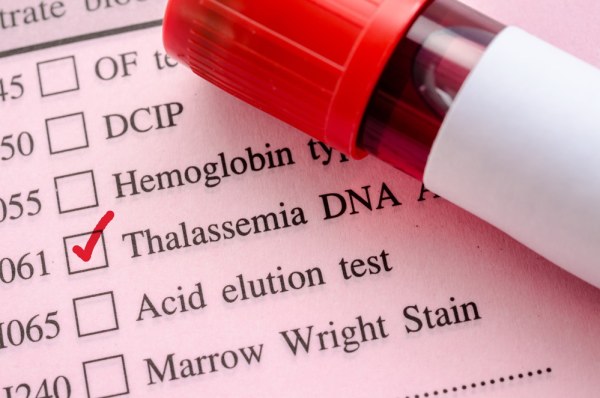 ใครมีพาหะธาลัสซีเมีย