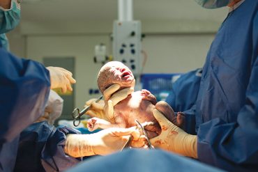 แม่ท้องจะผ่าคลอดได้กี่ครั้ง