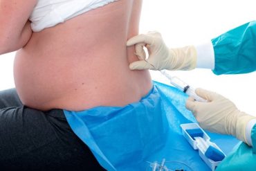 ทำไมไม่ฉีดบล็อกหลัง