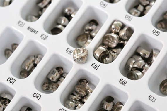 การครอบฟันเหล็ก