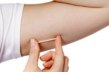 การฝังยาคุมดีไหม