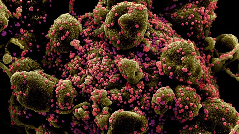 พบกับไวรัสโคโรนาสายพันธุ์บราซิล