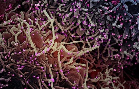 โควิดสายพันธุ์เอปซิลอนระบาด