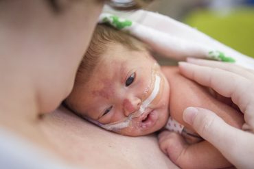 รู้จักการคลอดก่อนกำหนด