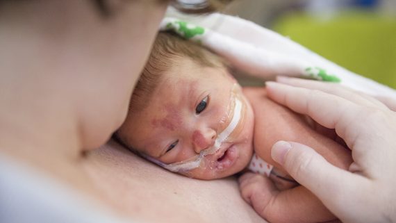 รู้จักการคลอดก่อนกำหนด