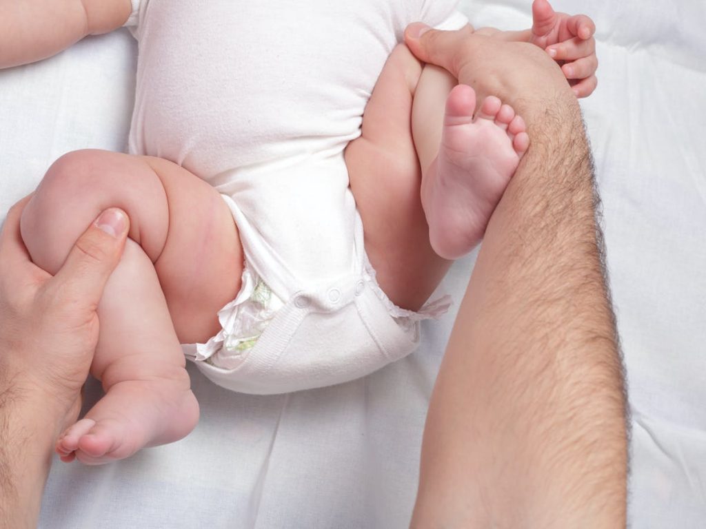 ข้อสะโพกเคลื่อนในทารก